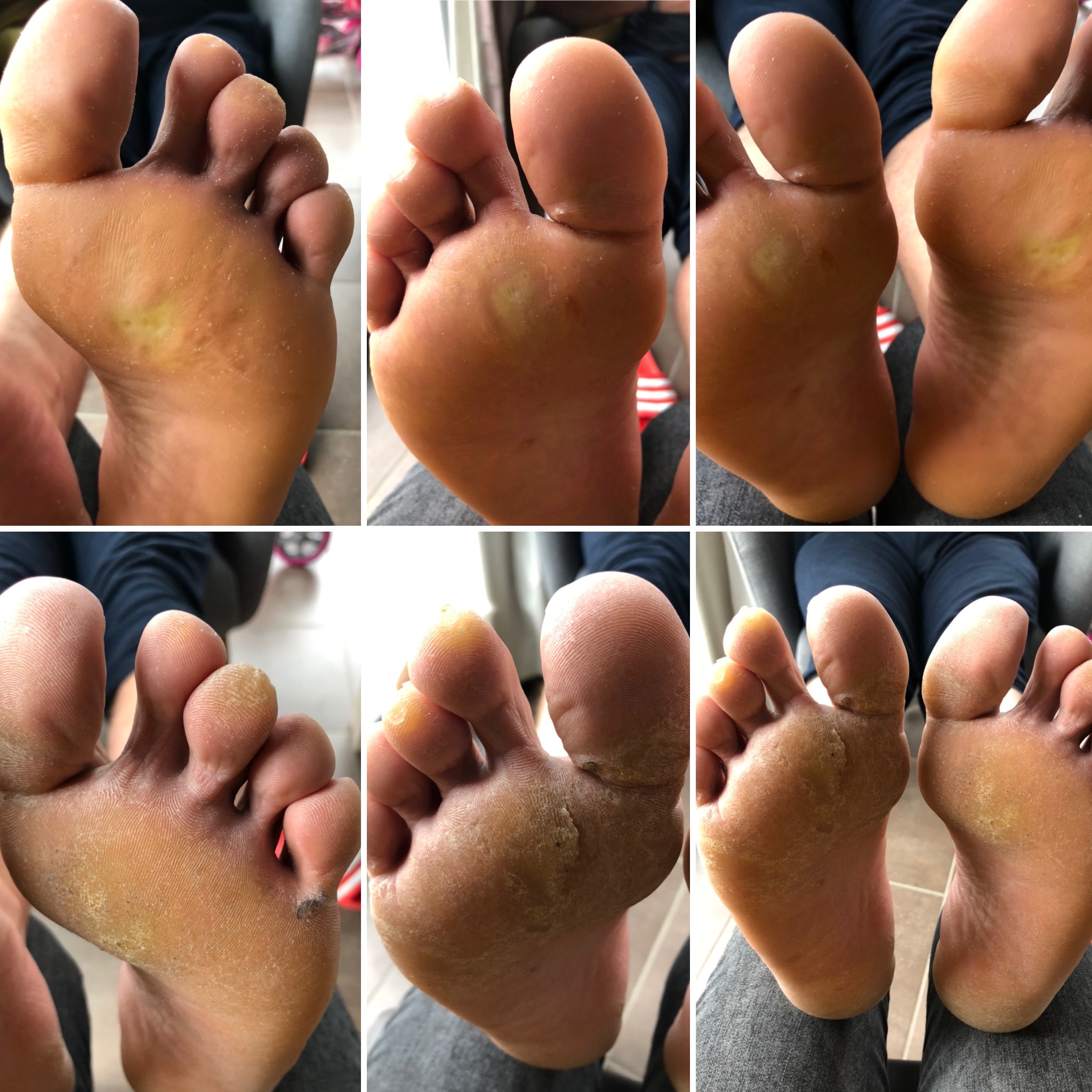 pedicuristen Zwevezele | Medisch pedicure Galloo Lindy