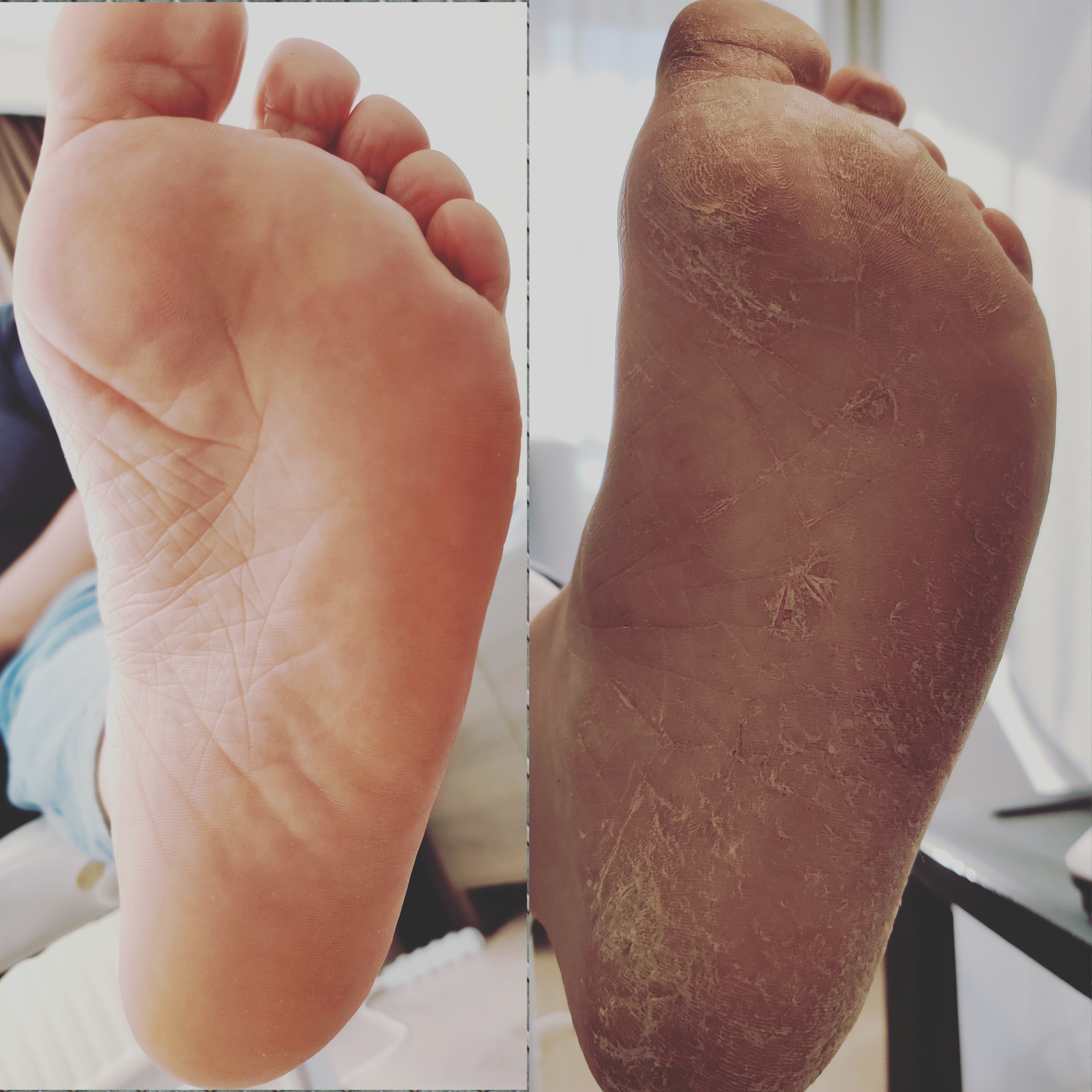 pedicuristen Mortsel | NagelsMortsel